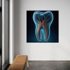 Cuadro decorativo canvas Muela 001